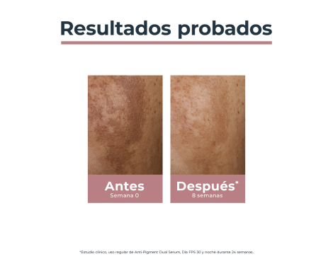 Para qué sirve Eucerin AntiPigment Crema Noche 50ml