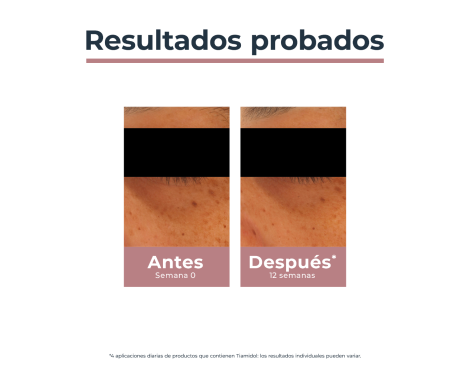 Comprar Eucerin Antipigment Contorno de Ojos Despigmentante y Antiojeras 15ml
