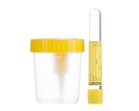Alvita-Kit-Envase-AsepticoTubo-De-Vacio-Esteril-0