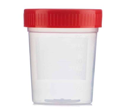 Envase-Esteril-Orina-0