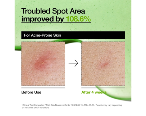 Anua Azelaic Acid 10 Hyaluron Redness Sérum Calmante 30ml sin receta