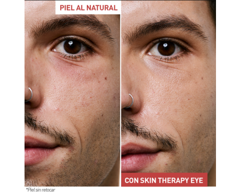 Beneficios de Erborian Skin Therapy Eye 15ml