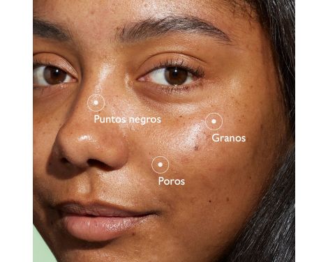 Caudalie Vinopure Sérum Salicílico Anti-Imperfecciones 30ml sin receta