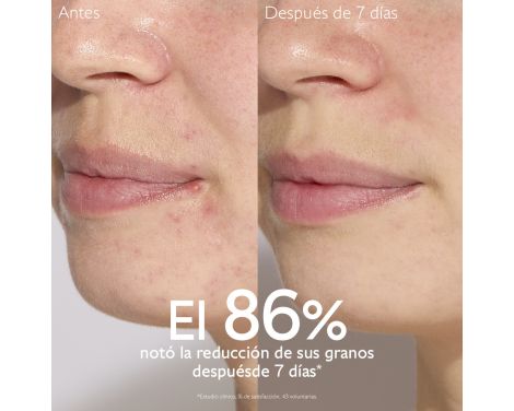 Para qué sirve Caudalie Vinopure Sérum Salicílico Anti-Imperfecciones 30ml