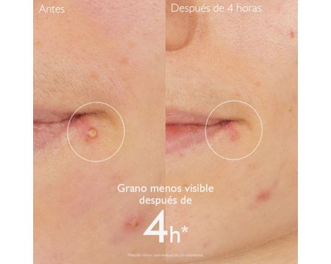 Comprar Caudalie Vinopure Stop Granos Salicílico 15ml