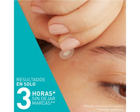 Comprar Cerave Parches Control Imperfecciones 22 Unidades
