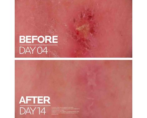 La Roche Posay Cicaplast Baume B5+ 100ml Hidratación y cuidado