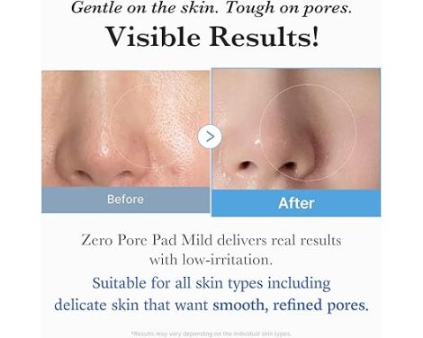 Medicube Zero Pore Pad Mild Discos Exfoliantes 70 Uds sin receta