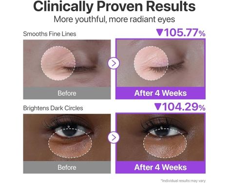 Para qué sirve Numbuzin No.9 Contorno de Ojos con Retinol Volumetox 10ml