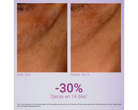 Para qué sirve Primaderm Contorno Xpert Expression Contour 15ml