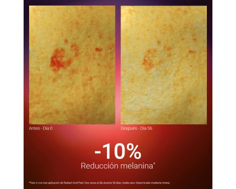 Para qué sirve Primaderm Peeling Radiant Acid Peel 10ml