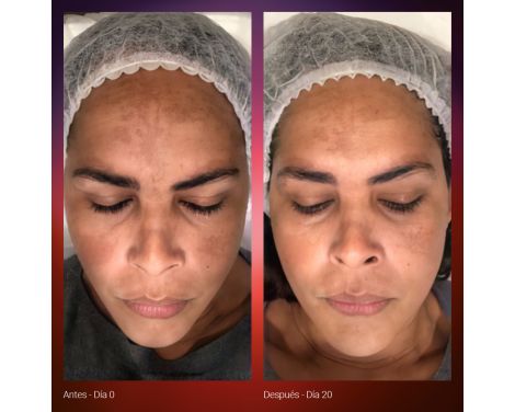 Para qué sirve Primaderm Sérum Radian Dual Serum 30ml