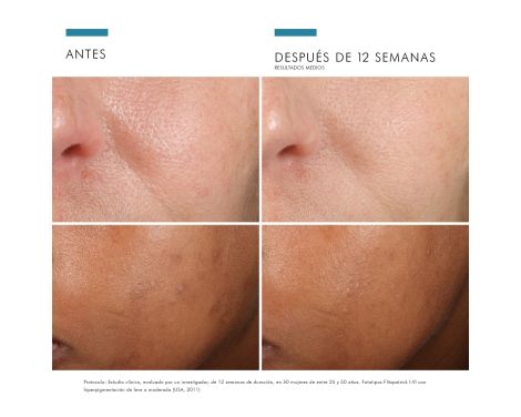 Para qué sirve Skinceuticals Phloretin CF 30ml