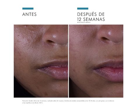 Para qué sirve Skinceuticals Silymarin CF 30ml