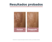 Para qué sirve Eucerin AntiPigment Crema Noche 50ml