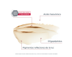 Opiniones Eucerin Antipigment Contorno de Ojos Despigmentante y Antiojeras 15ml