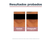 Comprar Eucerin Antipigment Contorno de Ojos Despigmentante y Antiojeras 15ml