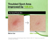 Anua Azelaic Acid 10 Hyaluron Redness Sérum Calmante 30ml sin receta