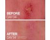 La Roche Posay Cicaplast Baume B5+ 100ml Hidratación y cuidado