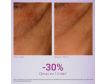 Para qué sirve Primaderm Contorno Xpert Expression Contour 15ml