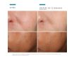 Para qué sirve Skinceuticals Phloretin CF 30ml