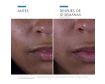Para qué sirve Skinceuticals Silymarin CF 30ml